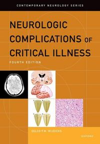 Produktbild: Neurologic Complications of Critical Illness