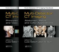 Produktbild: Multi-Detector CT Imaging Handbook, Two Volume Set