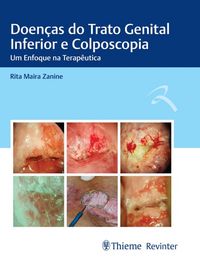 Produktbild: Doen&ccedil;as do Trato Genital Inferior e Colposcopia