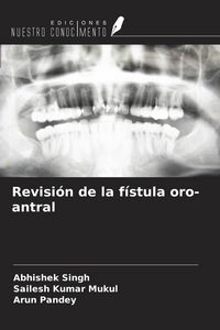 Produktbild: Revisi&oacute;n de la f&iacute;stula oro-antral
