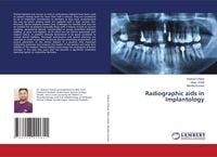 Produktbild: Radiographic aids in Implantology
