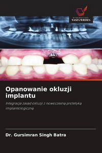Produktbild: Opanowanie okluzji implantu