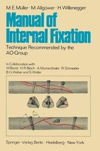 Produktbild: Manual of Internal Fixation
