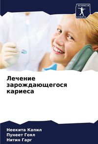 Produktbild: Lechenie zarozhda&uuml;schegosq kariesa