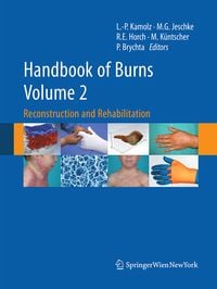 Produktbild: Handbook of Burns Volume 2