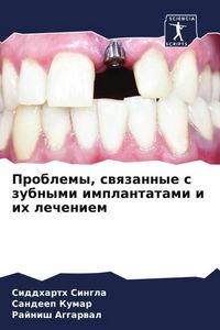 Produktbild: Problemy, swqzannye s zubnymi implantatami i ih lecheniem