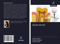 Produktbild: Apicale extrusie
