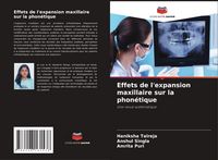 Produktbild: Effets de l'expansion maxillaire sur la phon&eacute;tique
