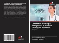 Produktbild: Cataratta: eziologia, patogenesi e metodo chirurgico moderno