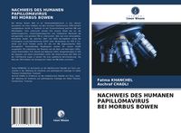 Produktbild: NACHWEIS DES HUMANEN PAPILLOMAVIRUS BEI MORBUS BOWEN