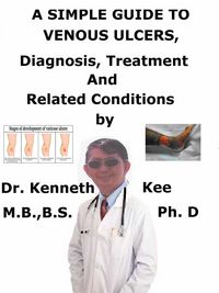 Produktbild: A Simple Guide to Venous Ulcers, Diagnosis, Treatment and Related Conditions