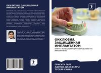Produktbild: Okkljuziya, Zashhishhennaya Implantatom