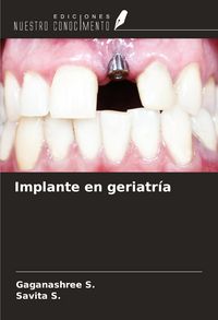 Produktbild: Implante en geriatr&iacute;a