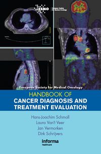 Produktbild: ESMO Handbook of Cancer Diagnosis and Treatment Evaluation