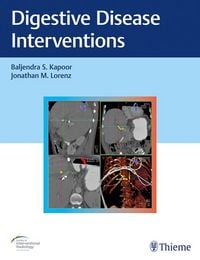 Produktbild: Digestive Disease Interventions