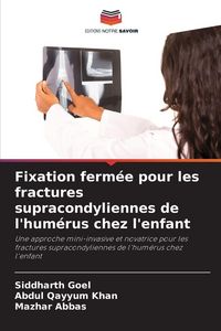 Produktbild: Fixation ferm&eacute;e pour les fractures supracondyliennes de l'hum&eacute;rus chez l'enfant