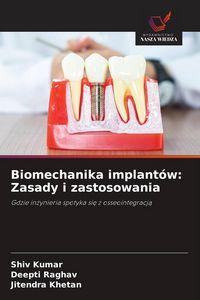 Produktbild: Biomechanika implant&oacute;w: Zasady i zastosowania