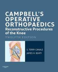 Produktbild: Campbell's Operative Orthopaedics: Reconstructive Procedures of the Knee E-Book
