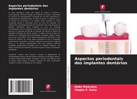 Produktbild: Aspectos periodontais dos implantes dent&aacute;rios