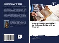 Produktbild: Manifesta&ccedil;&otilde;es orofaciais do linfoma de Burkitt no Malawi