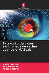 Produktbild: Extrac&ccedil;&atilde;o de vasos sangu&iacute;neos de retina usando o MATLab