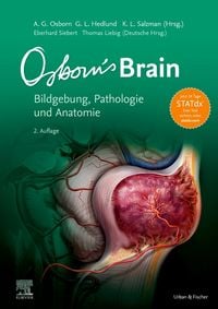 Produktbild: Osborn's Brain