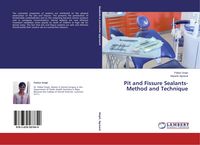 Produktbild: Pit and Fissure Sealants-Method and Technique