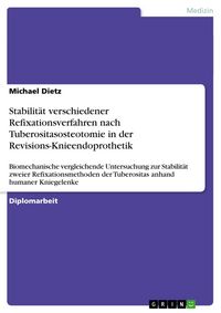 Produktbild: Stabilit&auml;t verschiedener Refixationsverfahren nach Tuberositasosteotomie in der Revisions-Knieendoprothetik