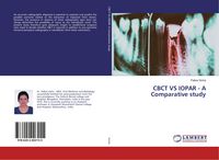 Produktbild: CBCT VS IOPAR - A Comparative study