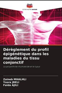 Produktbild: D&eacute;r&egrave;glement du profil &eacute;pig&eacute;n&eacute;tique dans les maladies du tissu conjonctif