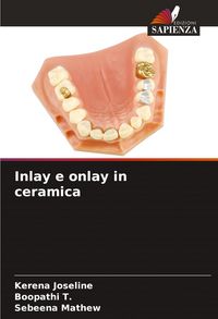 Produktbild: Inlay e onlay in ceramica