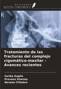 Produktbild: Tratamiento de las fracturas del complejo cigom&aacute;tico-maxilar - Avances recientes