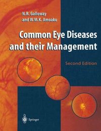 Produktbild: Common Eye Diseases and their Management