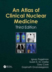 Produktbild: Atlas of Clinical Nuclear Medicine