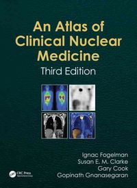 Produktbild: Atlas of Clinical Nuclear Medicine
