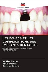 Produktbild: Les &Eacute;checs Et Les Complications des Implants Dentaires