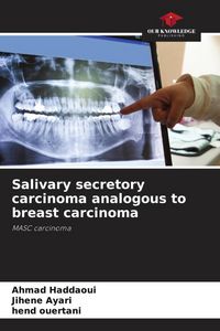 Produktbild: Salivary secretory carcinoma analogous to breast carcinoma