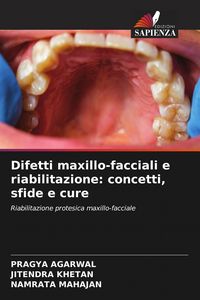 Produktbild: Difetti maxillo-facciali e riabilitazione: concetti, sfide e cure