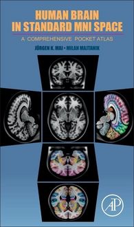 Produktbild: Human Brain in Standard Mni Space