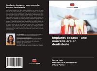 Produktbild: Implants basaux - une nouvelle &egrave;re en dentisterie