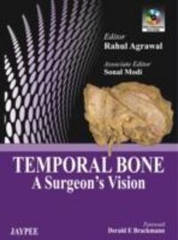 Produktbild: Temporal Bone