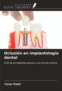 Produktbild: Oclusi&oacute;n en implantolog&iacute;a dental