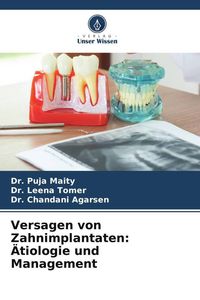 Produktbild: Versagen von Zahnimplantaten: &Auml;tiologie und Management