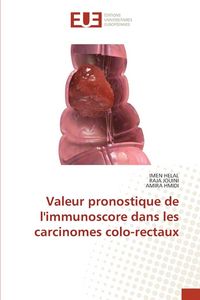 Produktbild: Valeur pronostique de l'immunoscore dans les carcinomes colo-rectaux