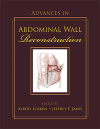 Produktbild: Advances in Abdominal Wall Reconstruction