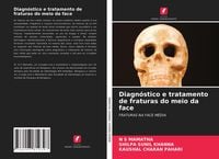 Produktbild: Diagn&oacute;stico e tratamento de fraturas do meio da face