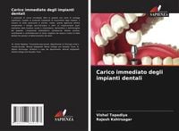 Produktbild: Carico immediato degli impianti dentali