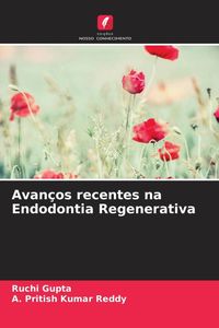 Produktbild: Avan&ccedil;os recentes na Endodontia Regenerativa