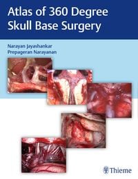Produktbild: Atlas of 360 Degree Skull Base Surgery