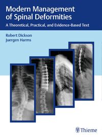 Produktbild: Modern Management of Spinal Deformities